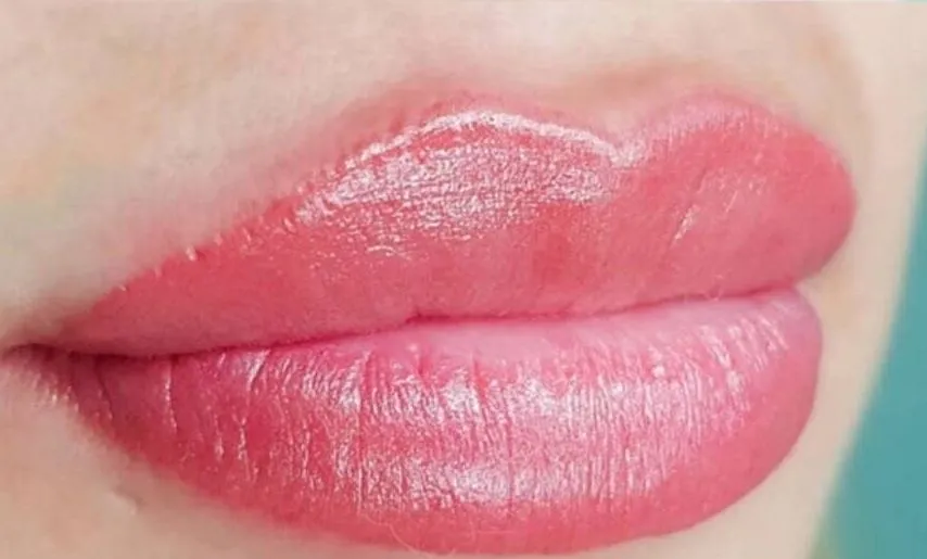 Labios: después
