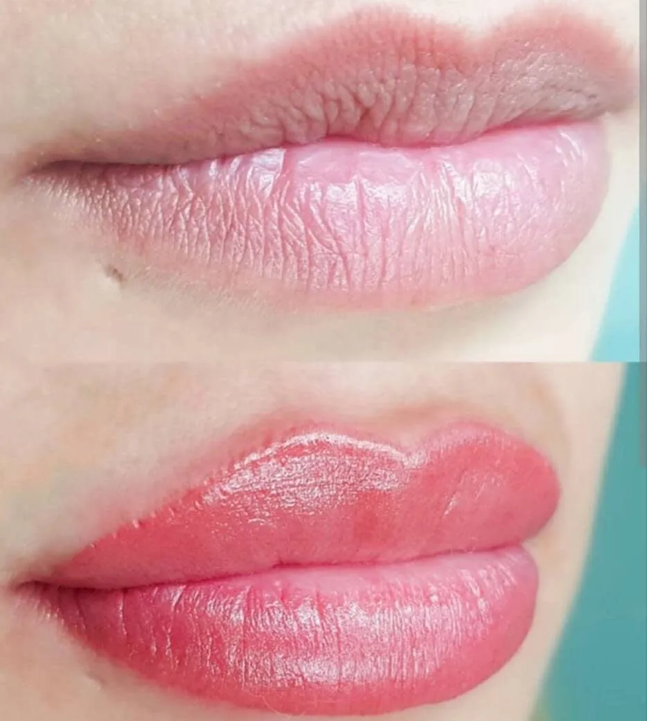 Labios antes y después de la micropigmentación